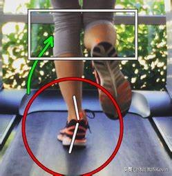 千里之行，始于“足下”——足外翻的5种解决方法