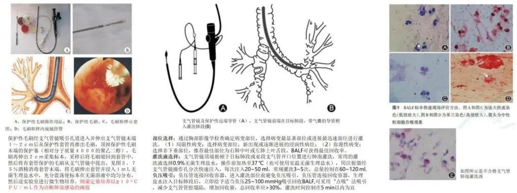 病原微生物检测是细菌培养吗,临床微生物检验与感染
