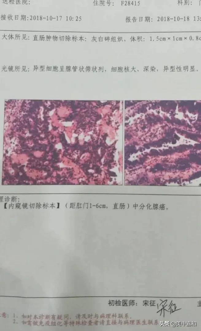 癌症妈妈的真相,癌症妈妈真实故事