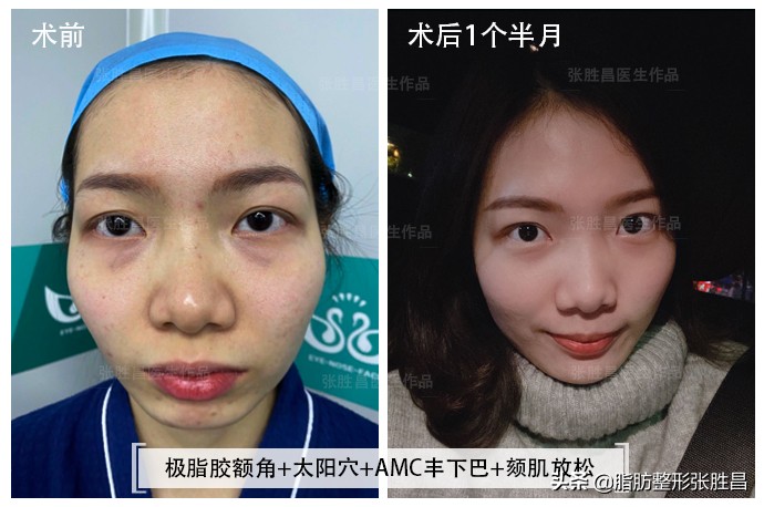 颧骨突出面相刻薄怎么办,脸型崎岖颧骨突出