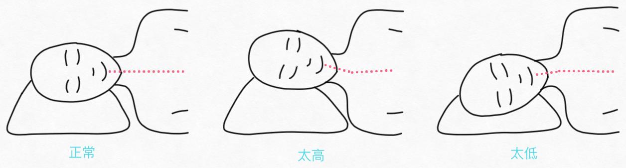 颈椎病每天睡醒脖子酸痛,睡醒脖子痛一招搞定