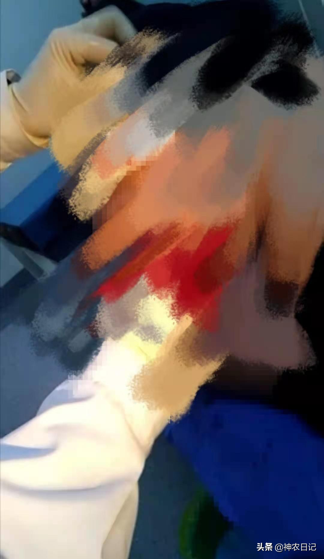 男50岁一干活就出汗是怎么回事,男子49岁突然口吐鲜血怎么回事