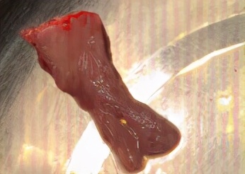 轮胎爆炸被钢圈压死,轮胎爆炸引起的事