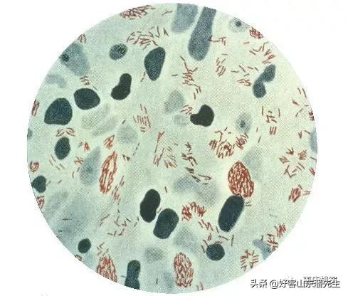 滕州麻风病,滕州麻风病医院现状