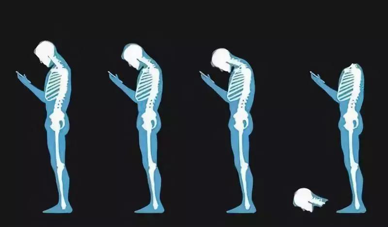 颈椎死穴的位置图解,治颈椎的死穴