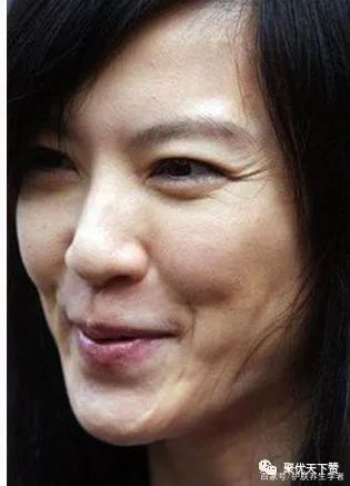 皱纹变多的症状,最近为什么突然有皱纹了