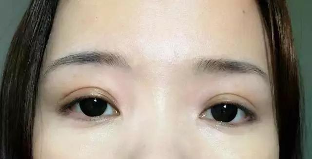 鼻头大怎么改善变小,鼻子不好看怎么办隆鼻