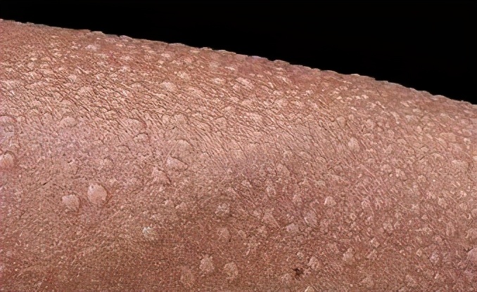 老寒腿膝盖保暖,老寒腿有救了吧