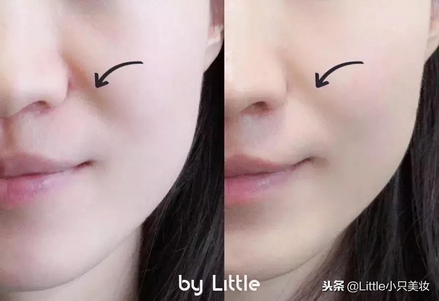 提拉瘦脸美容仪哪个牌子好,瘦脸美容仪推荐