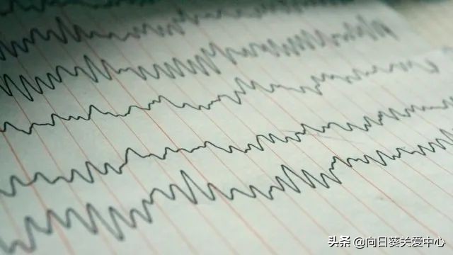 儿童癫痫减药停药后还需要复查吗,儿童癫痫病怎样评估停药后不复发