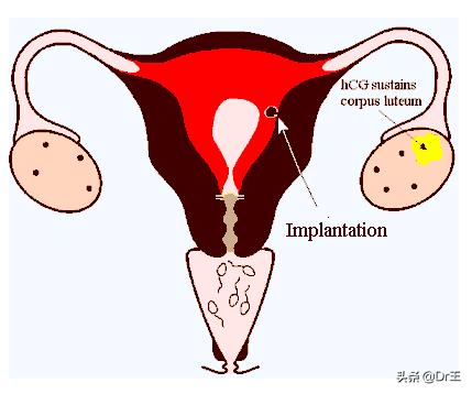 没做过人流内膜特别薄,子宫内膜变薄有可能怀孕吗