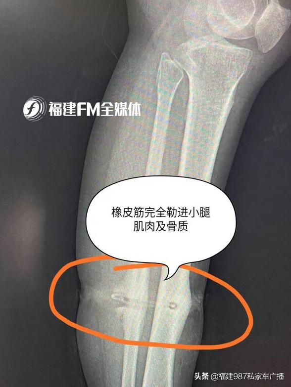 福建省级机关医院二甲,福建省级机关医院有哪些