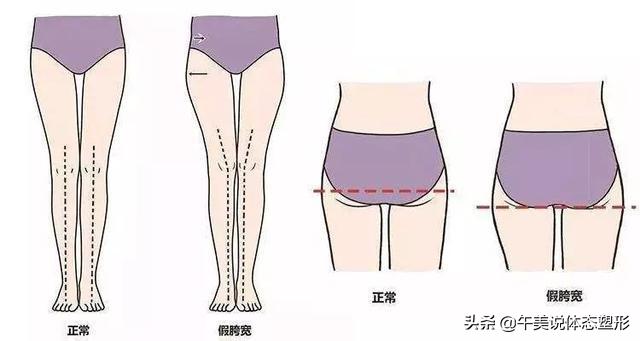 瘦腿瘦臀不翘屁股教程,虐臀圈怎么瘦腿