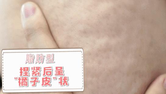 如何才能有一双长腿,如何拥有长腿