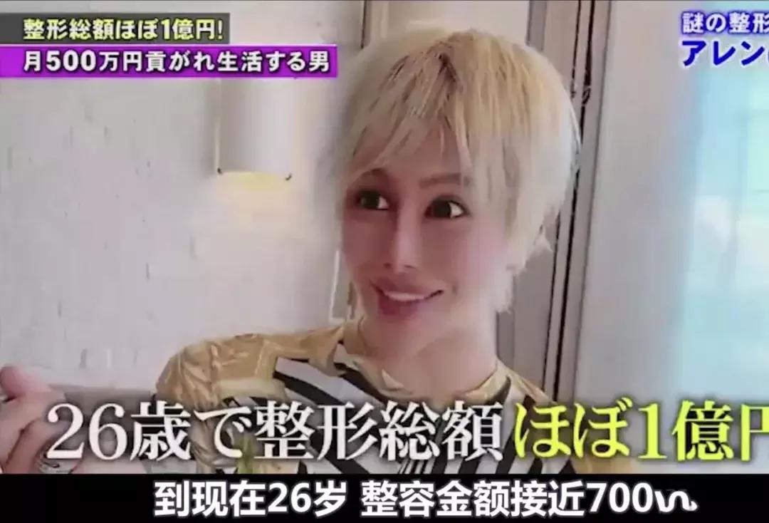 刘梓晨到底有没有整容啊,还记得整容界网红刘梓晨吗