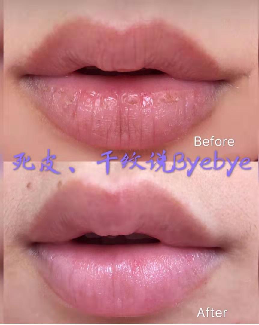 邓紫棋小红瓶,邓紫棋的金鱼嘴视频