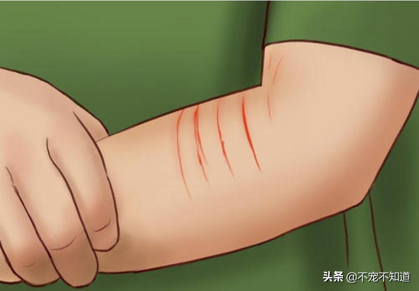 被猫咪抓伤到底要不要打狂犬疫苗,被猫咪抓伤死亡率有多少