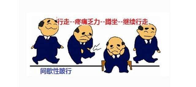 糖尿病足负压护理及观察要点,糖尿病足居家护理