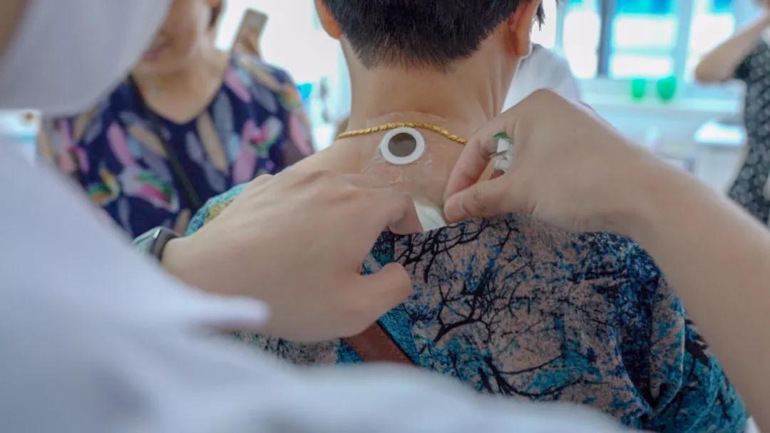 三伏天中医三伏贴,江苏省中医院可以预约三伏贴吗