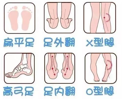 这几种凉鞋千万别给孩子穿,五种凉鞋避坑