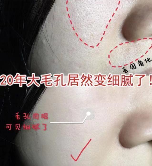 零毛孔让你的皮肤光滑细腻,教你一招搞定毛孔