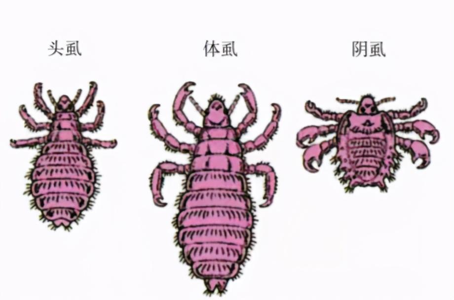 孩子眼睛长阴虱怎么处理,阴虱长在小孩眼睫毛上