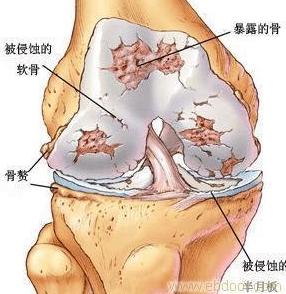 肉牛关节肿大怎么办,牛常见病辨认和治疗方法