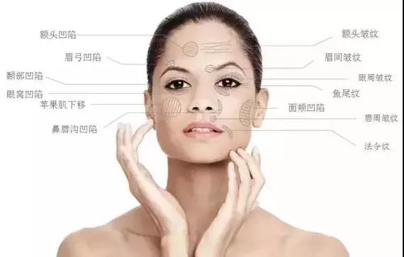 童颜针PK肉毒素