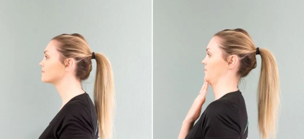 双下巴怎么减最快,双下巴怎么迅速减下来