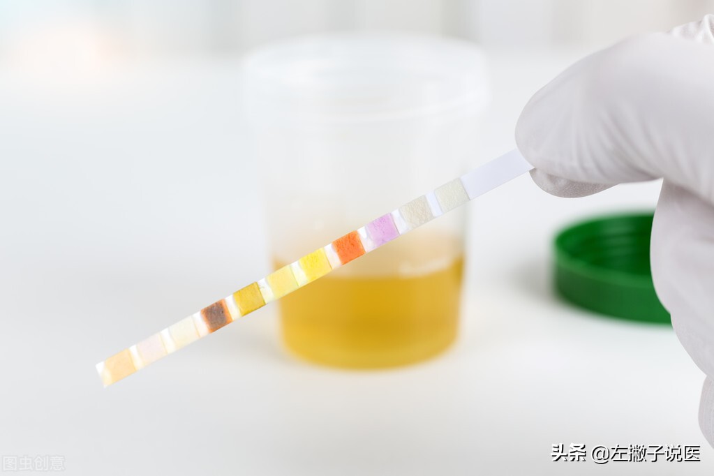 一喝水尿就多肾好还是不好,一喝水就尿多肾是好还是不好