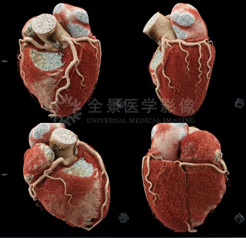 颈部肿块为什么有80%是肿瘤,颈部肿块1年没有变化