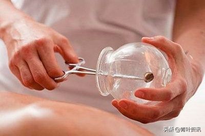 拔火罐到底对人好不好,拔火罐的好处和坏处有哪些