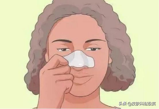 黑头和脂质微丝的区别,黑头里有白色的东西是脂质微丝吗