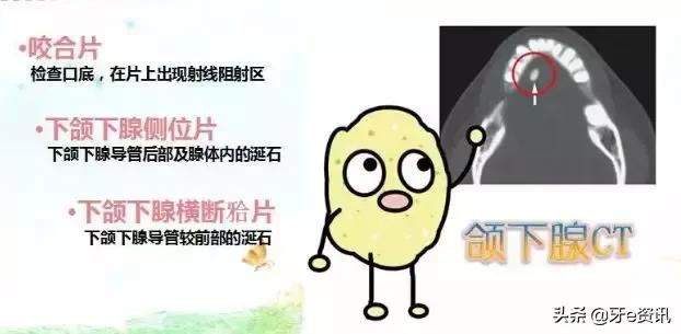 口腔三大疾病是哪几种,口腔里的结石有哪几种