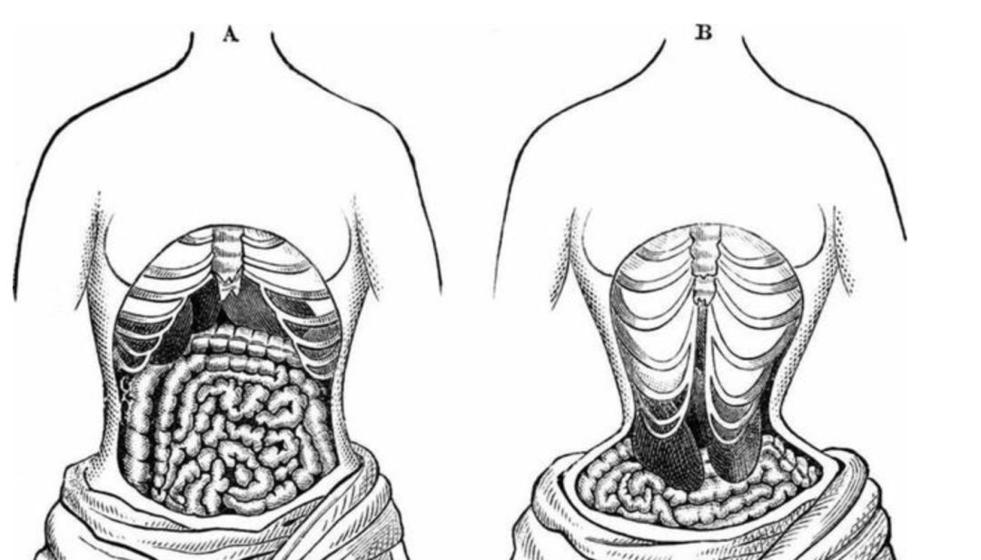 塑身衣100个问题,塑身衣收腹塑身衣