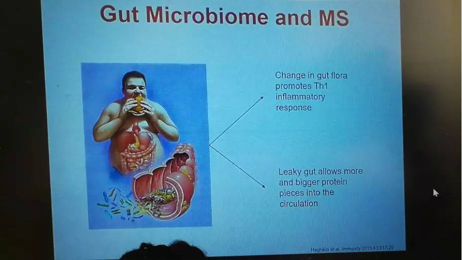 多发性硬化患者分享,多发性硬化的病例分享