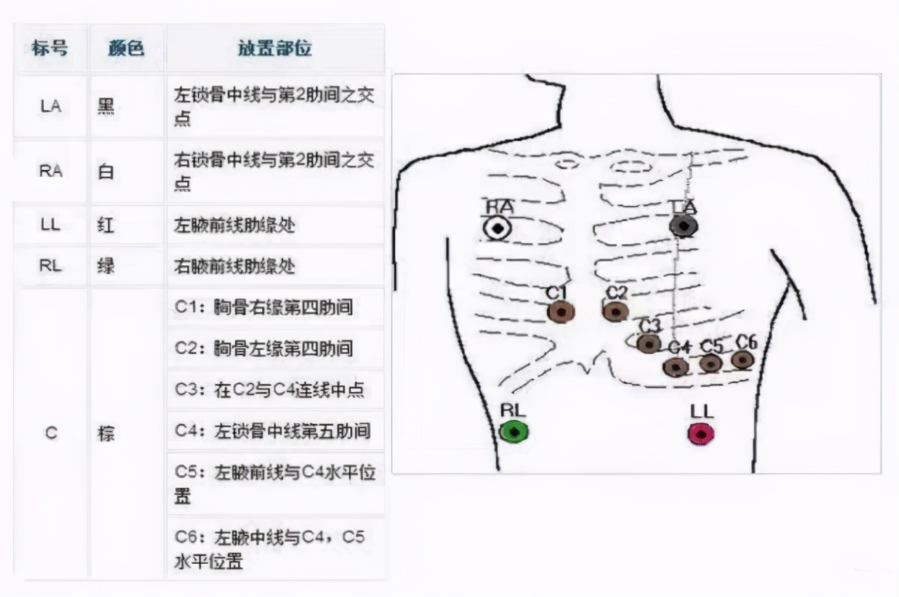 心电监护使用ppt,心电监护使用时间计算