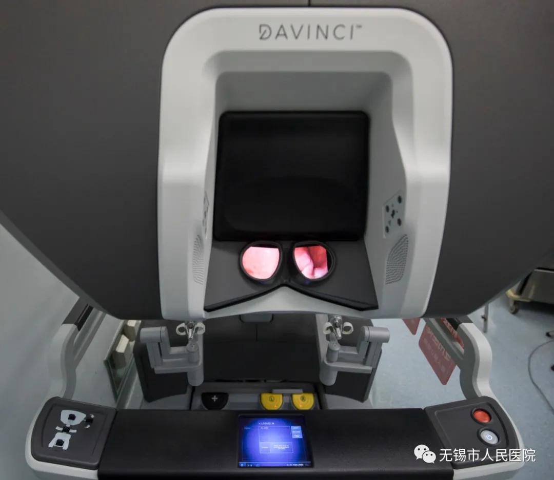 江苏人民医院机器人,无锡人民医院机器人手术多少钱