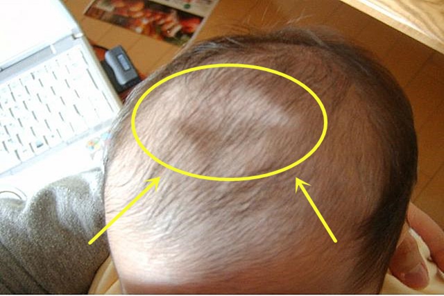 新生儿囟门怎么护理,护理宝宝囟门正确的方法是