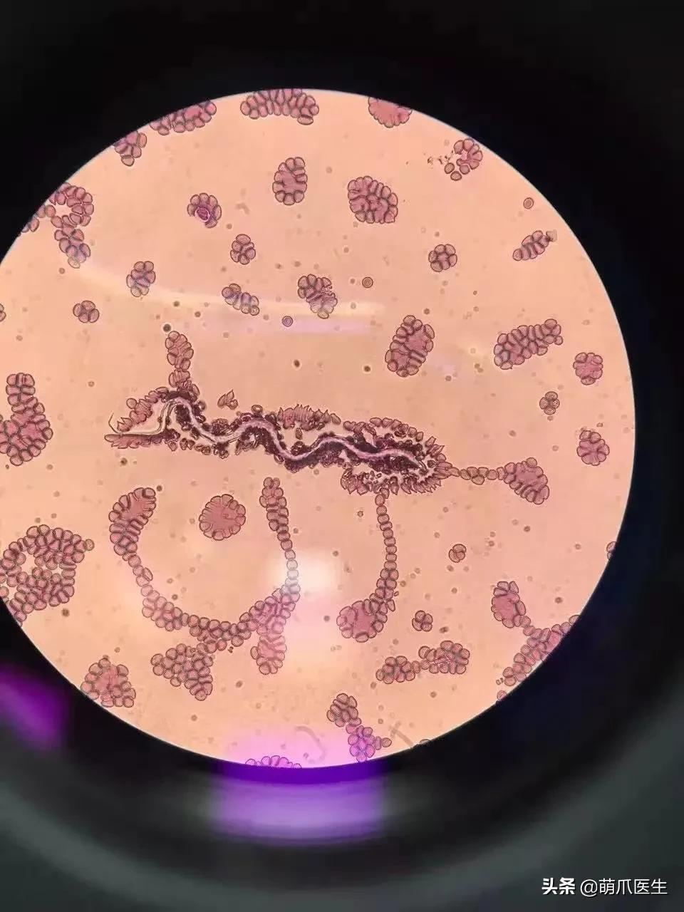 一只蚊子带来的灾难,一只蚊子毁了一个晚上的睡眠