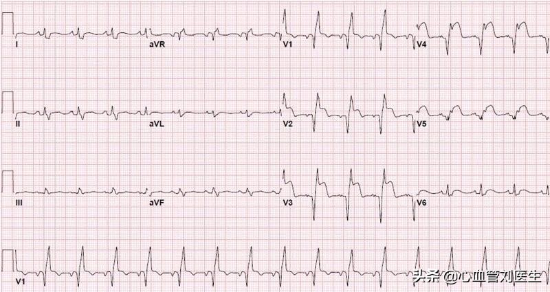老人伤心过度的症状,因伤心过度引起心痛胸闷是什么病