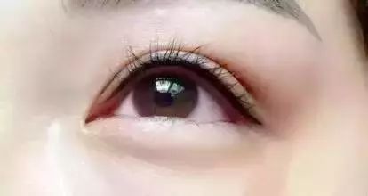 如何看美瞳线是否留色,怎么判断美瞳线是否结痂了
