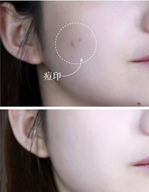 oliveyoung平价气垫,平价好用的气垫推荐毛孔大瑕疵多