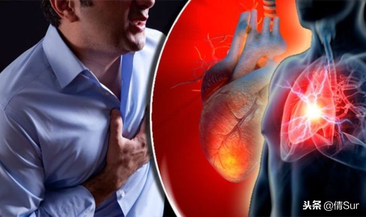 心源性猝死马拉松,马拉松心脏猝死的抢救