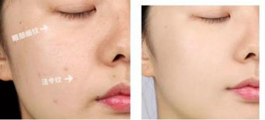 2023大牌精华液抗皱紧致抗衰老,500元以内最好用的精华