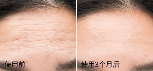 越敷皮肤越嫩的泥膜,没皱纹提拉紧致女神的冻龄神器