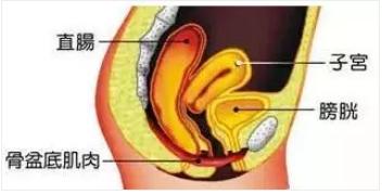 产后盆底肌修复训练一般做几个,产后盆底肌修复注意事项