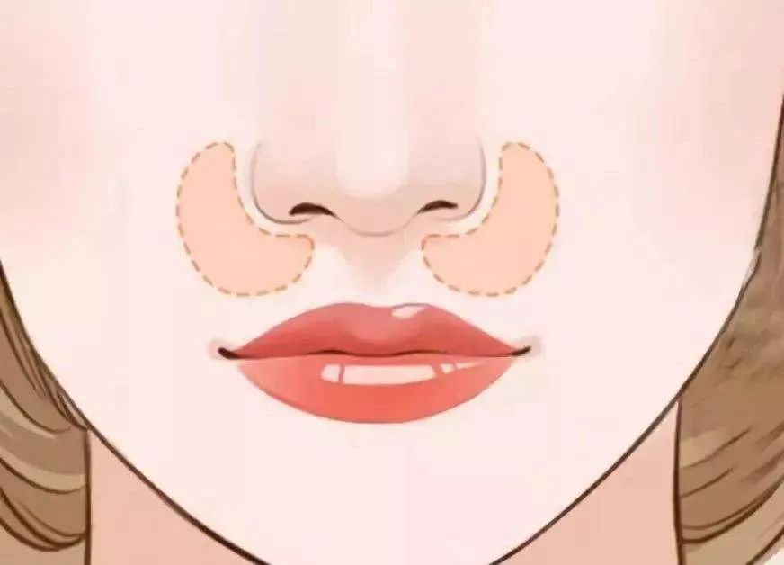 美颜都遮不住的法令纹该怎么回答,滤镜才是法令纹的天敌