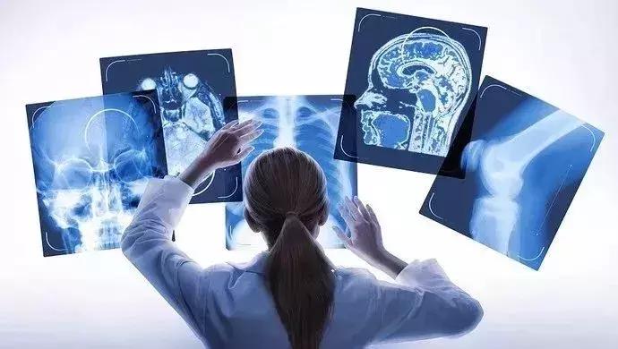 外国早期筛查癌症,petct用于诊断癌症