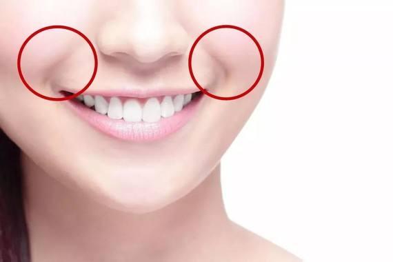 法令纹太明显怎么改善女明星,杨紫法令纹能去除吗